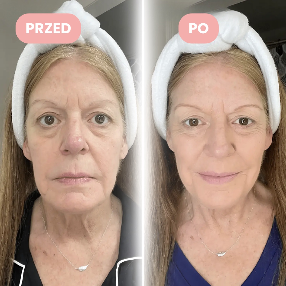 Halina, ok. 65 lat, przed i po