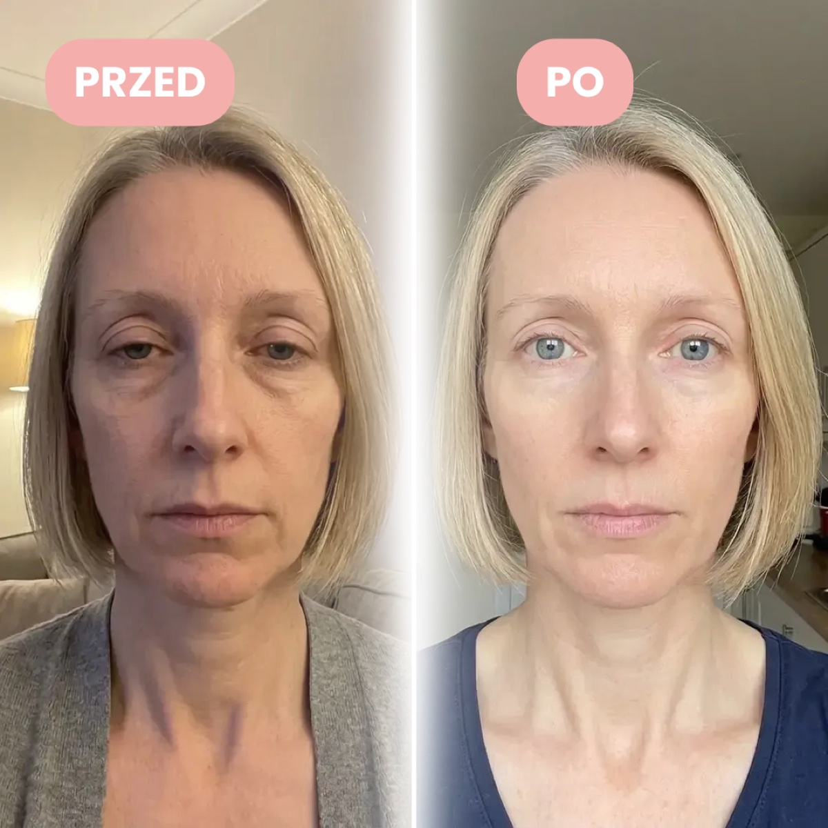 Dorota, ok. 48 lat, przed i po