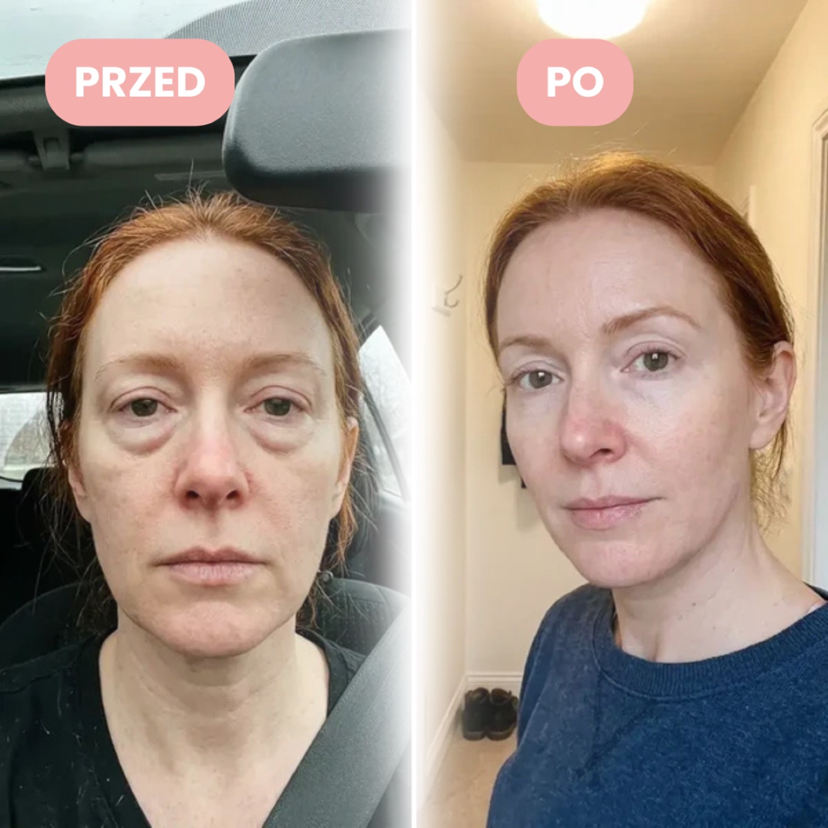 Joanna, ok. 41 lat, przed i po