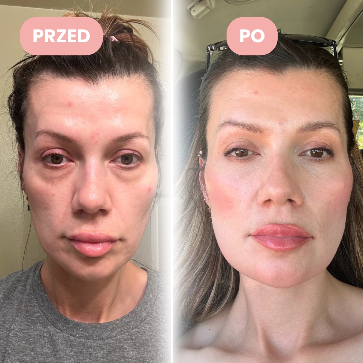 Karolina, ok. 36 lat, przed i po