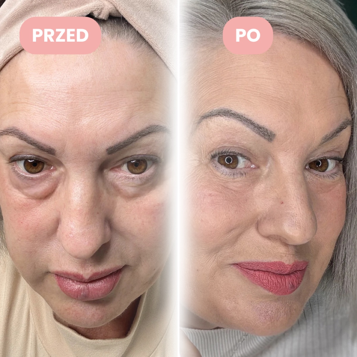 Elżbieta, ok. 58 lat, przed i po